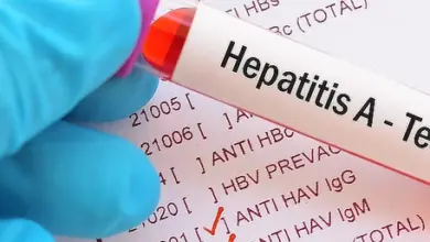 Hepatitis a test tube