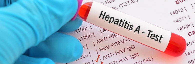 Hepatitis a test tube