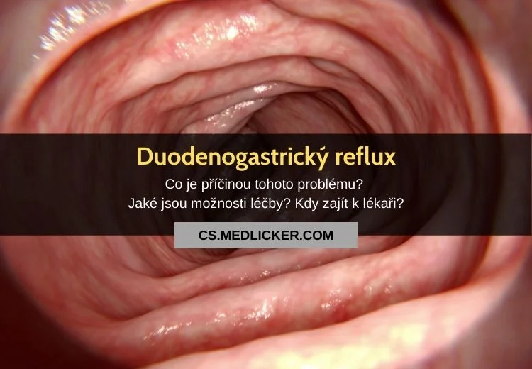 Endoskopický pohled na sliznici žaludku při duodenogastickém refluxu.