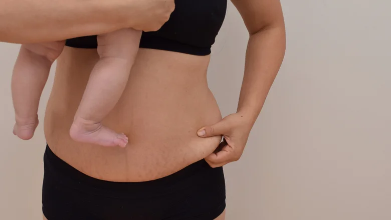 Žena s dítětem ukazuje volnou kůži na břiše po porodu.