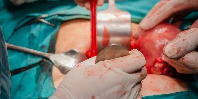 Chirurgický zákrok při sterilizaci s nástroji v rukou lékaře